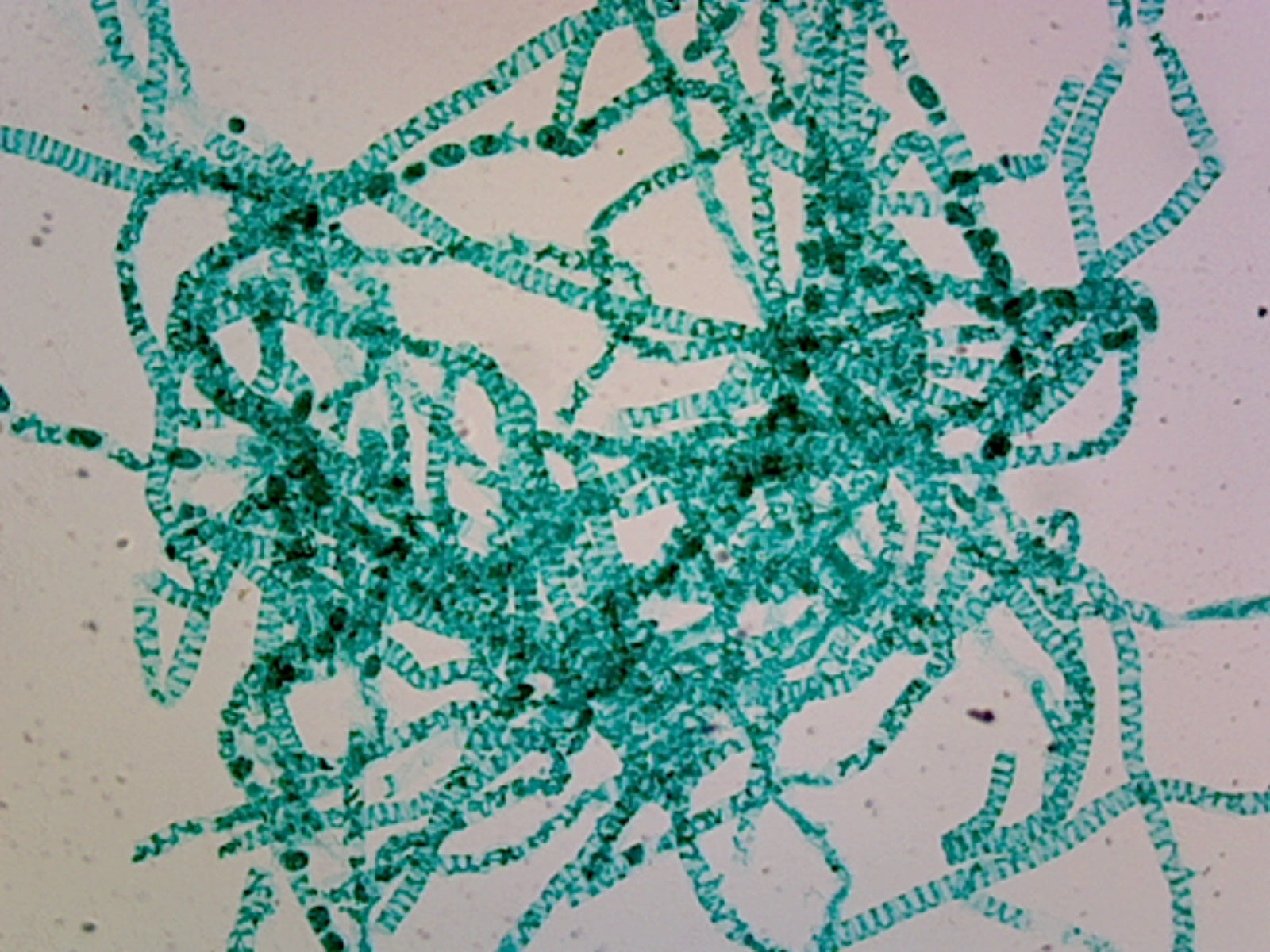 Gsc International Spirogyra Scalariform Conjugation; Showing Zygote