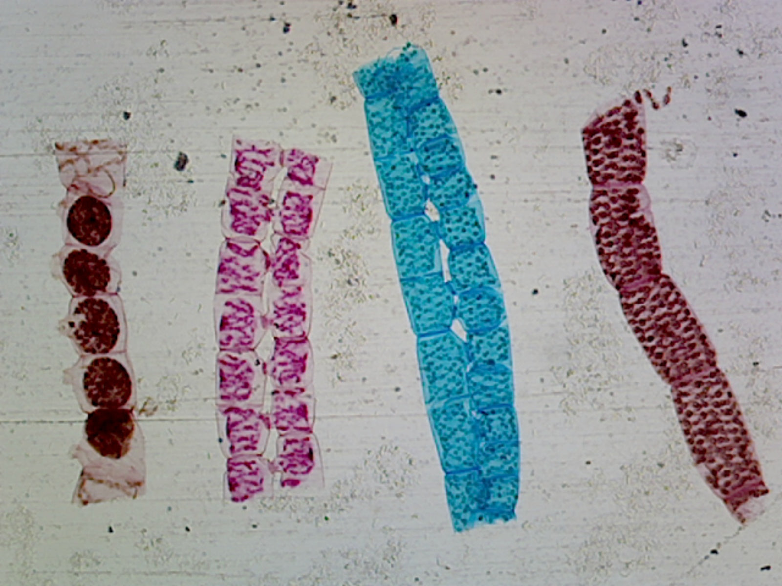 Gsc International Spirogyra, Scalariform Conjugation; All Stages; Whole ...