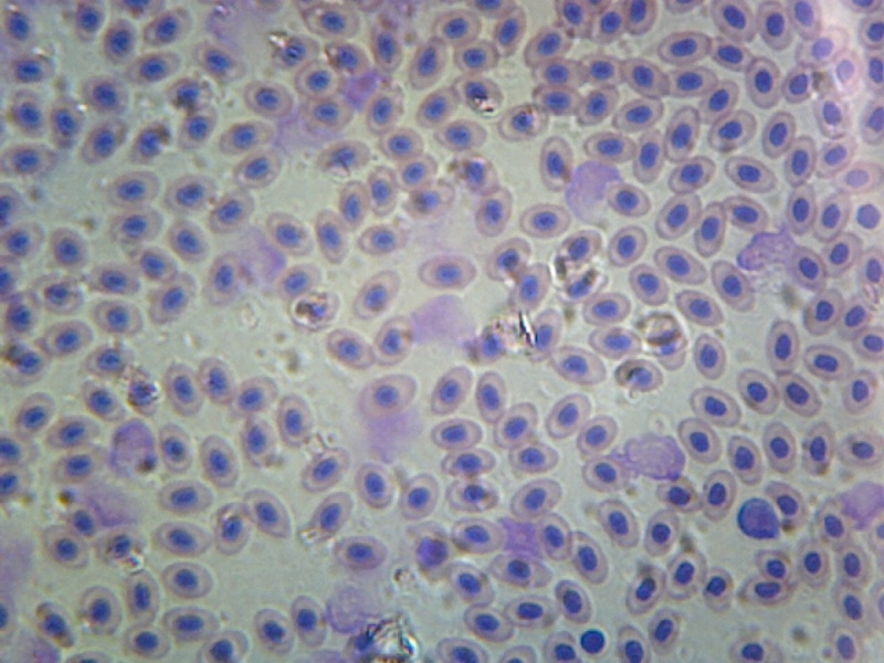 Gsc International Bird Blood; Smear
