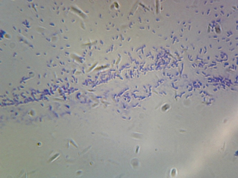 Gsc International Bacillus; Smear; Mixed Gram-Positive And Gram-Negative