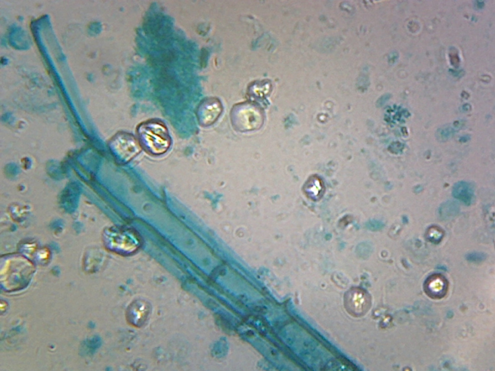 Gsc International Anabaena; BlueGreen Algae; Filamentous Cyanobacteria