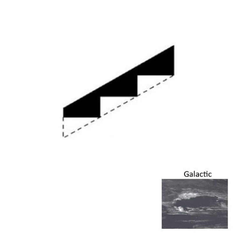 Marbleized Galactic Rubber Stringers - Smooth
