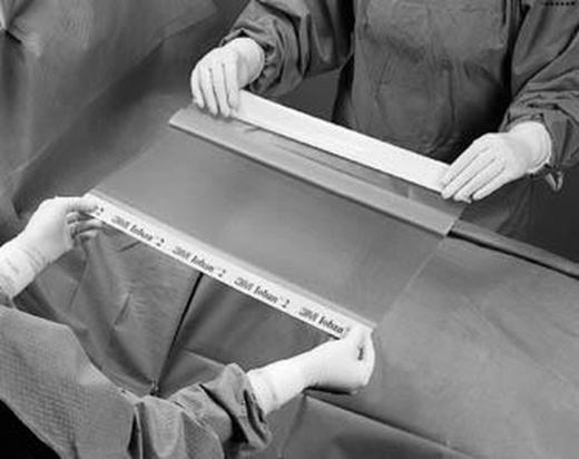 3M 6651Ez Ioban 2 Antimicrobial Incise Drape